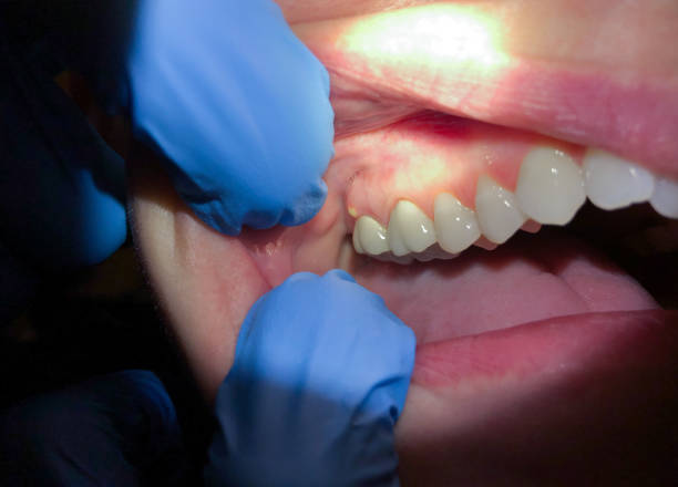 Best Emergency TMJ Treatment in Batesville, MS